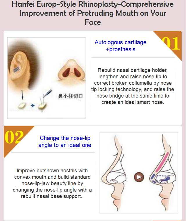 rhinoplasty with convex mouth