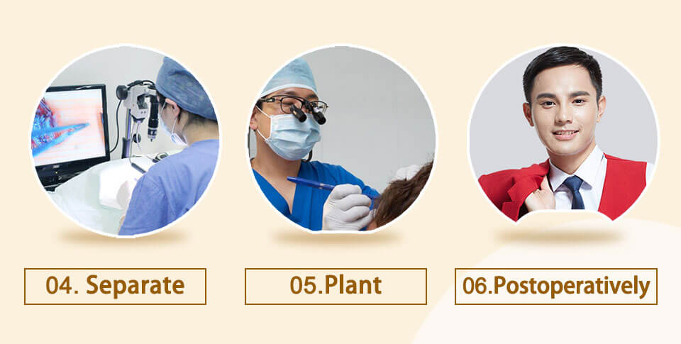 seperate, plant and postoperatively